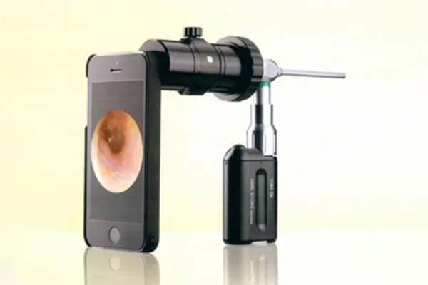 SMART SCOPEの写真